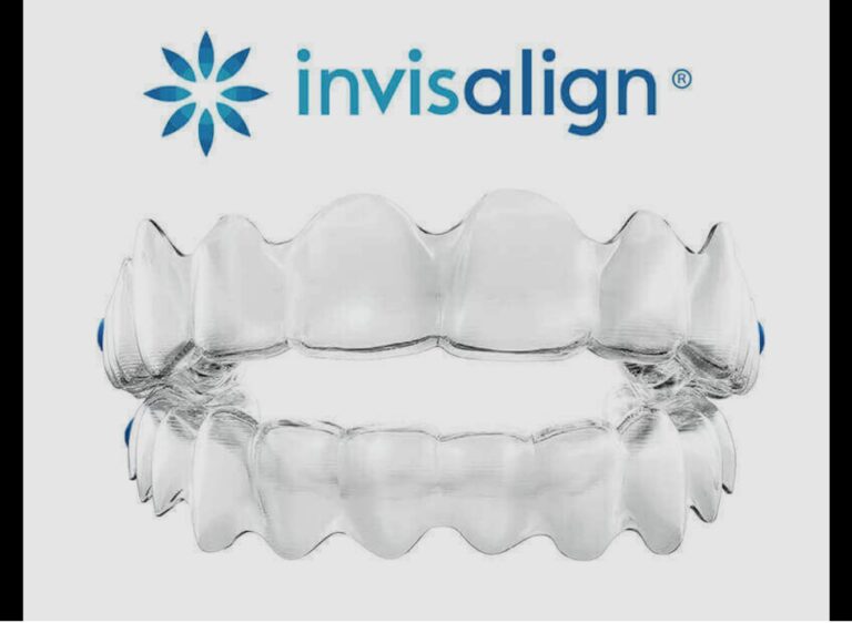 Aligners / Invisible Braces